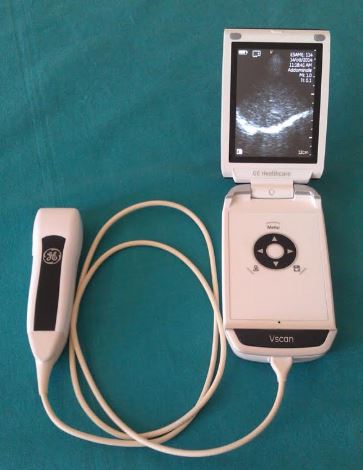 Arriva l' ecoscopio, la visita e' con il mini-ecografo portatile. Lo  stetoscopio va in soffitta - Salute H24