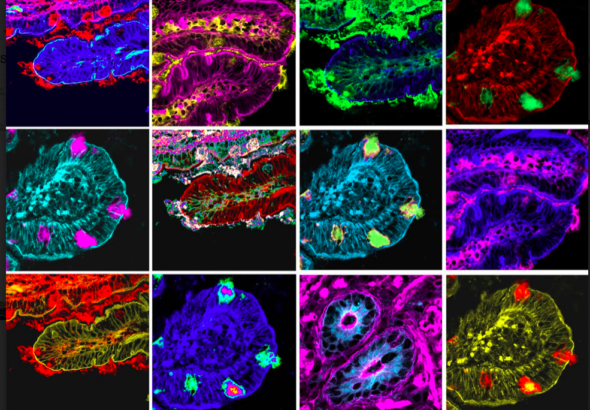intestino microbiota batteri