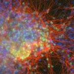 neurons-regen-med_0