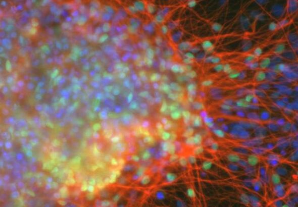 neurons-regen-med_0
